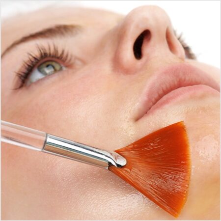 MicroLaser Peel