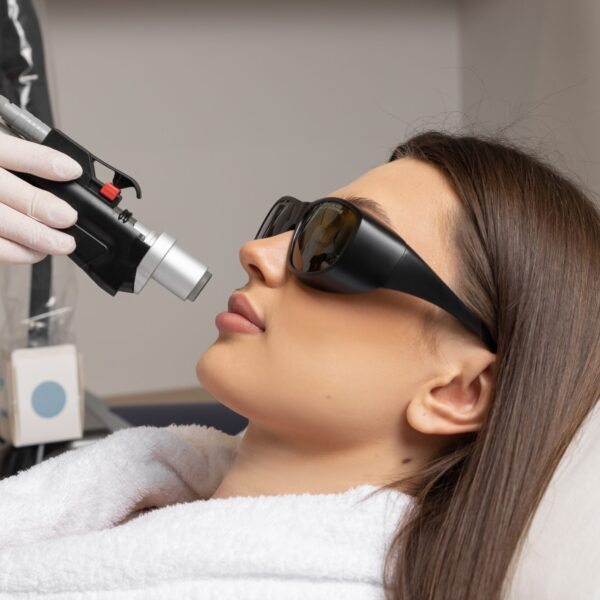 NanoLaser Peel